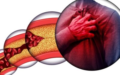 Atherosclerosis the Unseen Invader in Cardiovascular System