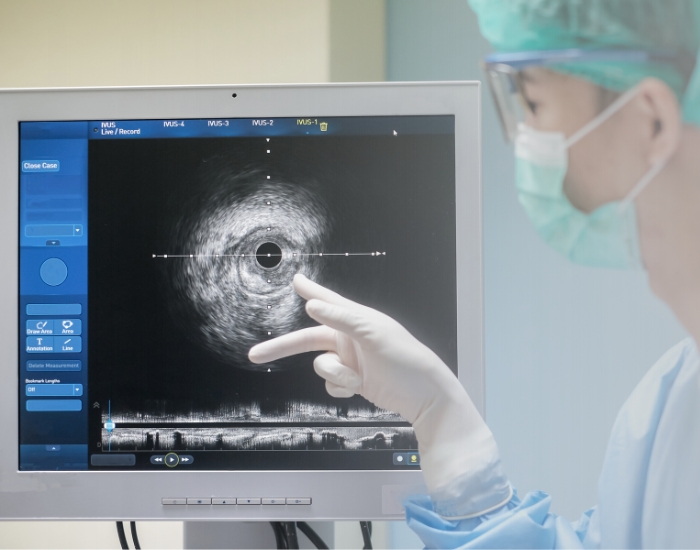 Top Cardiac Catheterization & Angiography in Katy, TX | Advanced ...