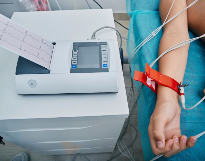 ECG rhythm strip showing heart electrical activity
