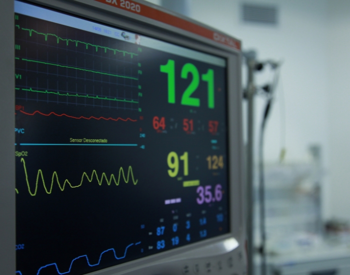 Heart rhythm monitoring device used after an abnormal EKG