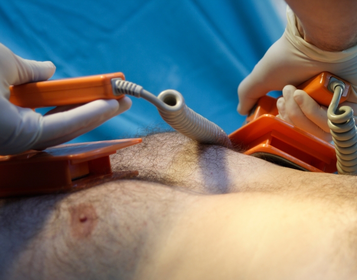 Cardioversion in Katy